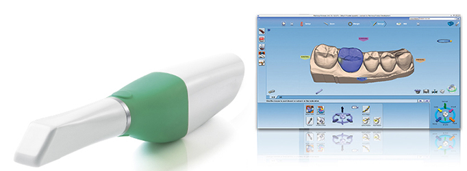 Empreinte-optique-Docteur-Tran